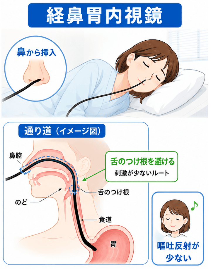 経鼻内視鏡